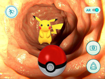 Pikachu Spotted in Man's Colon.jpg