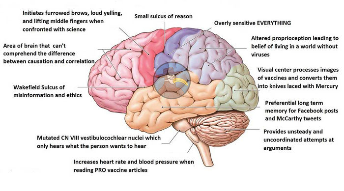 Brain Mutations in the Anti-Vaxxer.jpg